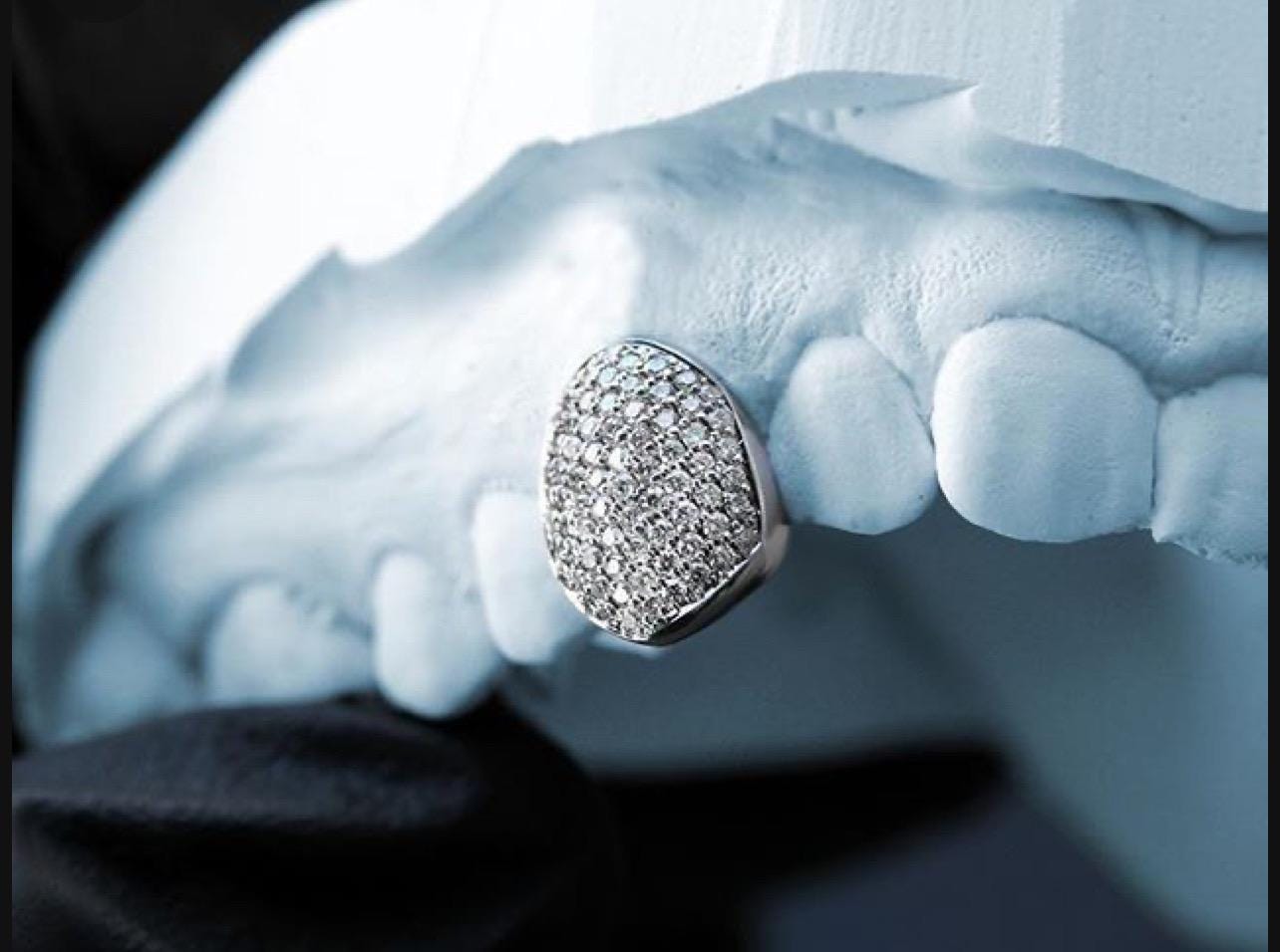 Custom Bustdown Grillz: Hand-Set Lab Diamonds, Silver or Gold