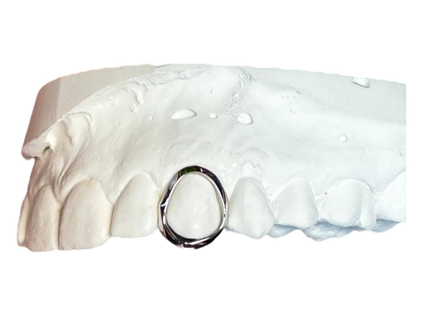 Custom Gold Grillz: Open Face Design, High-Gloss Polish