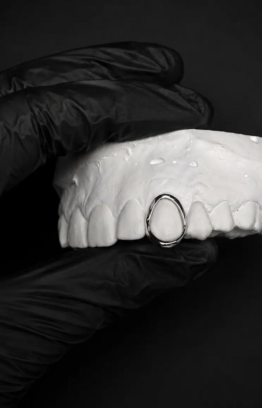 Custom open face grillz with gold upper teeth and silver lower teeth on a white dental model