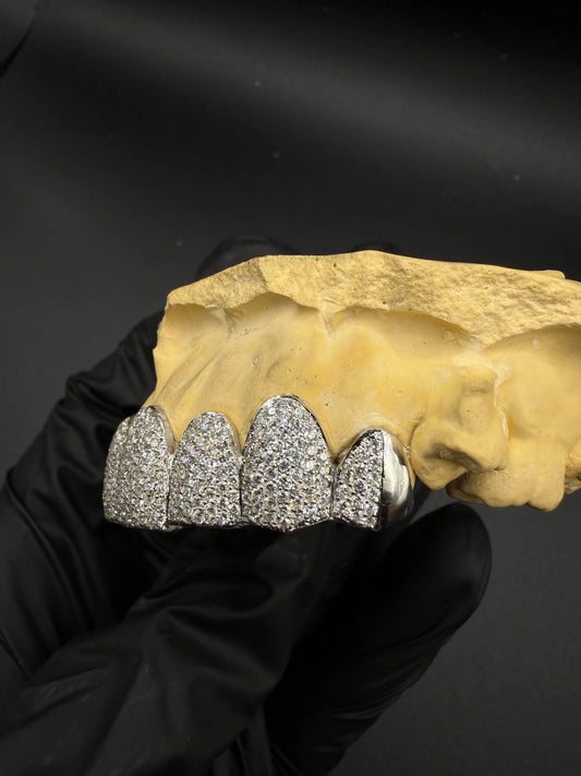 Side view of custom iced lab diamond grillz with hand-set VVS lab diamonds