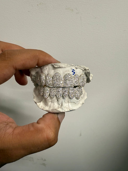 Side profile of custom moissanite snowset grillz in silver and gold