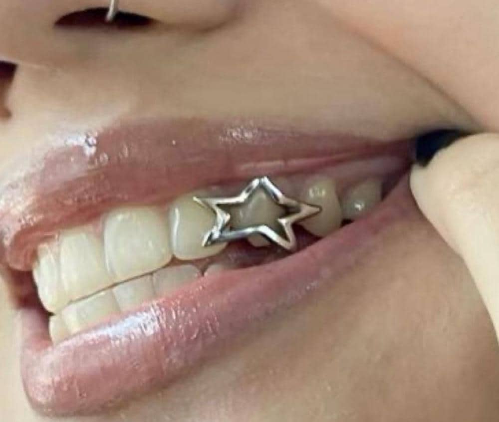 Star Shape Grillz Custom Made - silver and gold Grillz - fast shipping - high end polish