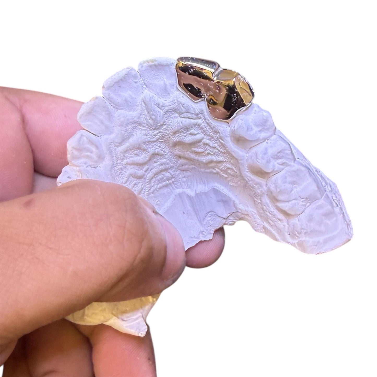 Custom Double Grillz Set – VVS Lab Diamond, Gold or Silver