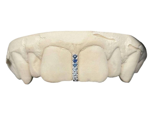 Iced Out Diamond Gap Grillz: Custom Gemstone Tooth Cap