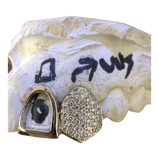 Custom Double Grillz Set – VVS Moissanite diamond , Gold or Silver