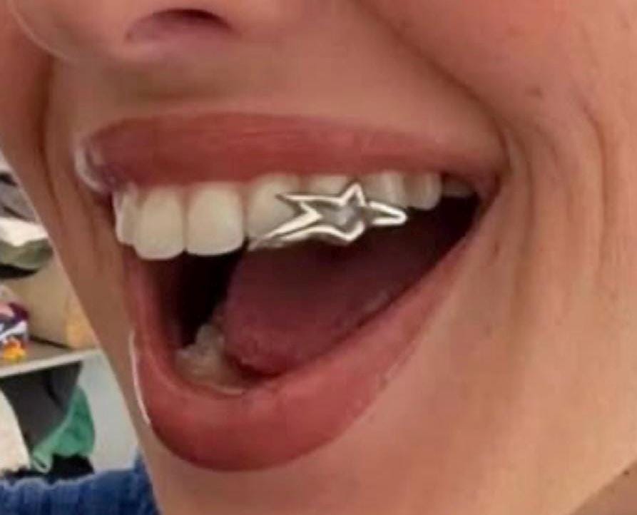 Star Shape Grillz Custom Made - silver and gold Grillz - fast shipping - high end polish