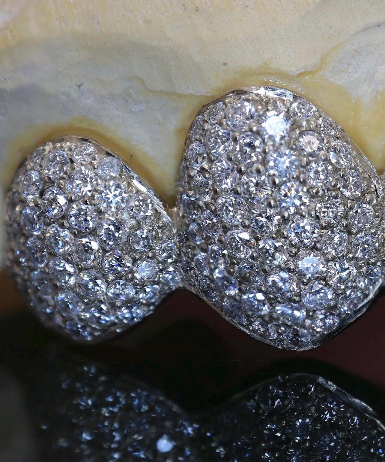 Custom Iced Grillz: VVS Moissanite, Sterling Silver or Gold