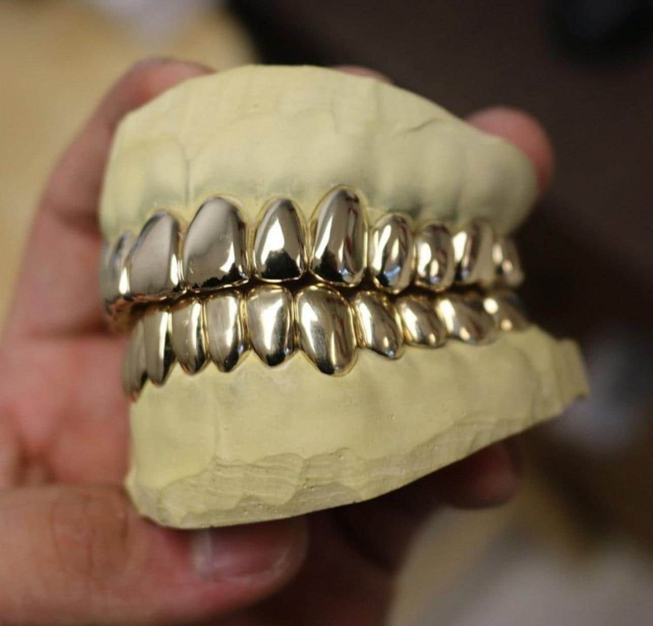 Custom Handmade Grillz: Solid Silver or Gold, Precision Fit