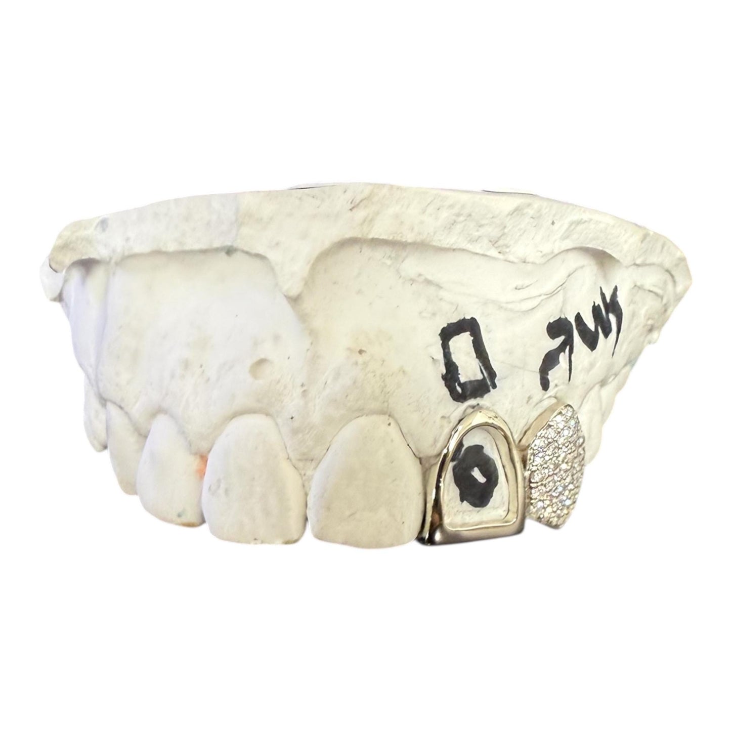 Custom Double Grillz Set – VVS Moissanite diamond , Gold or Silver