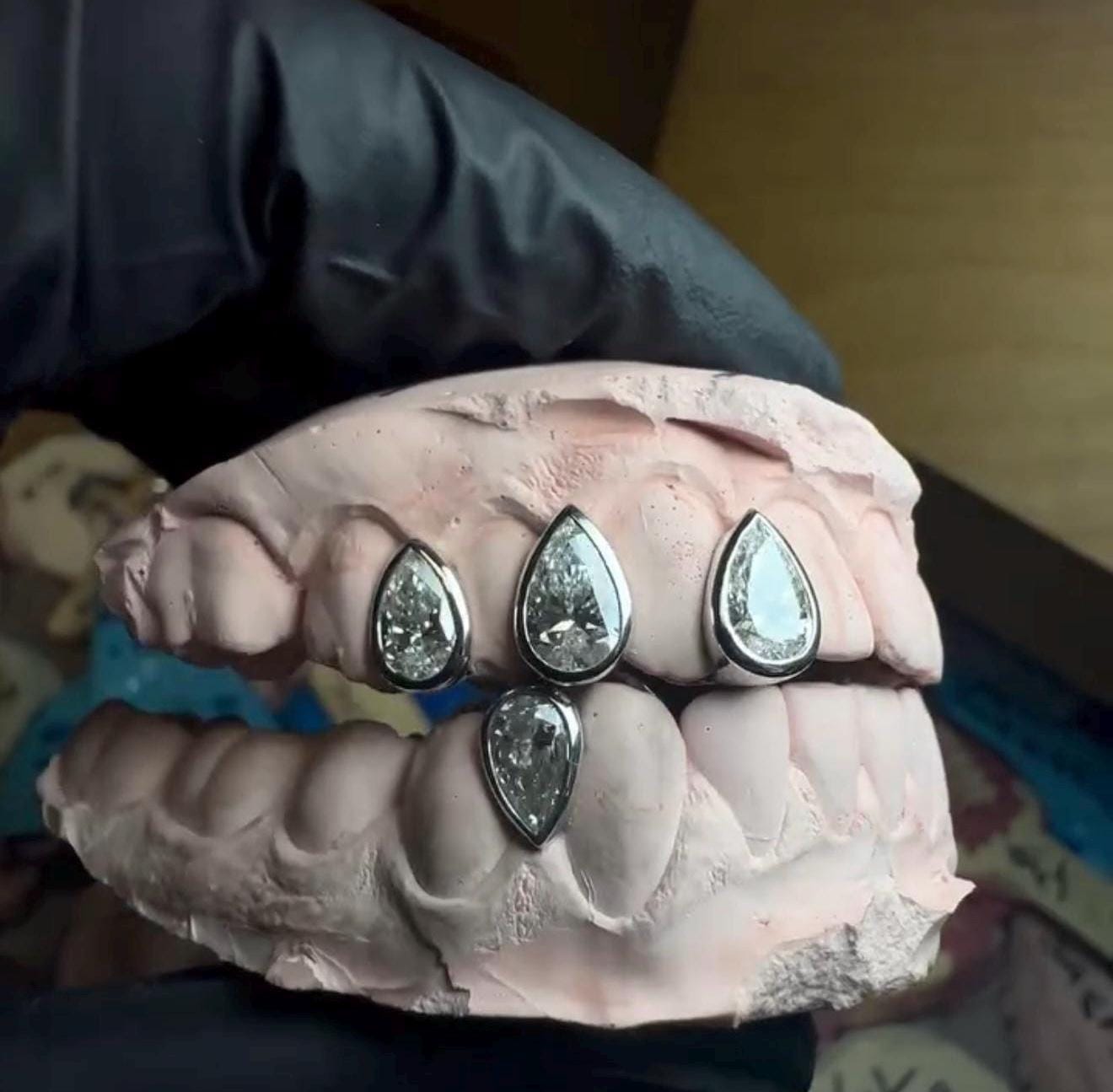 Custom Pear-Cut Diamond Grillz: 925 Silver or Solid Gold, VVS Stones
