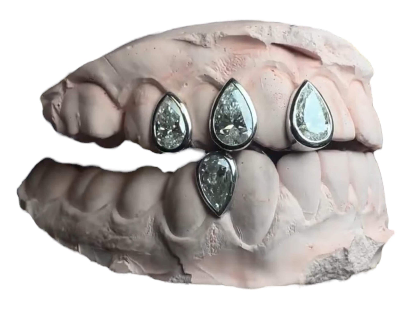 Custom Pear-Cut Diamond Grillz: 925 Silver or Solid Gold, VVS Stones