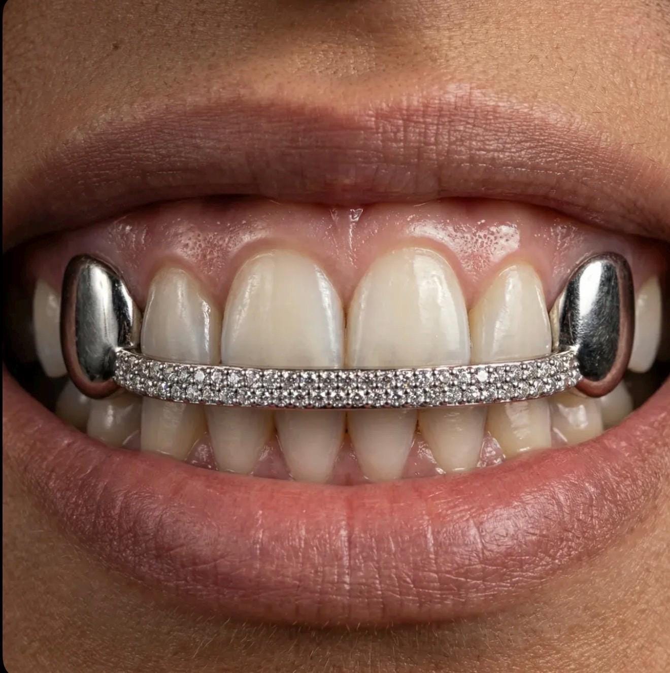 Custom diamond bar vvs Lab grown grillz