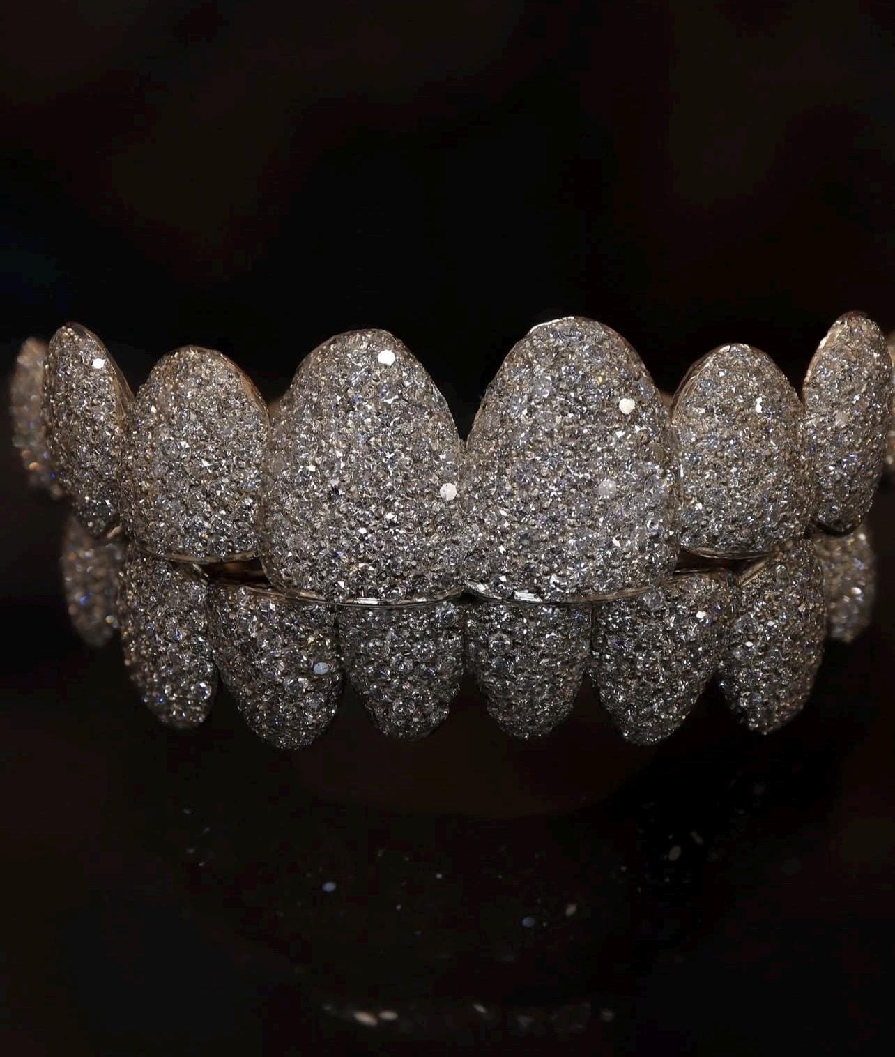 Custom Bustdown Grillz: Hand-Set Lab Diamonds, Silver or Gold
