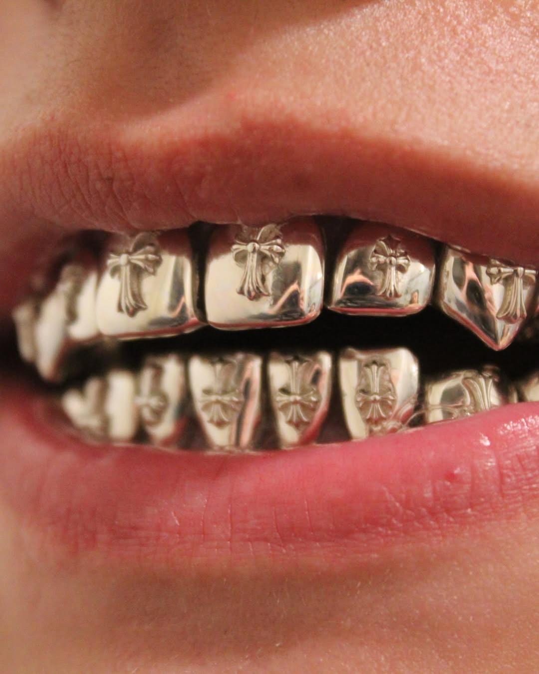 CAD-designed Cross Grillz  – 925 Silver or 9K/14K Gold – Dental-Grade Fit