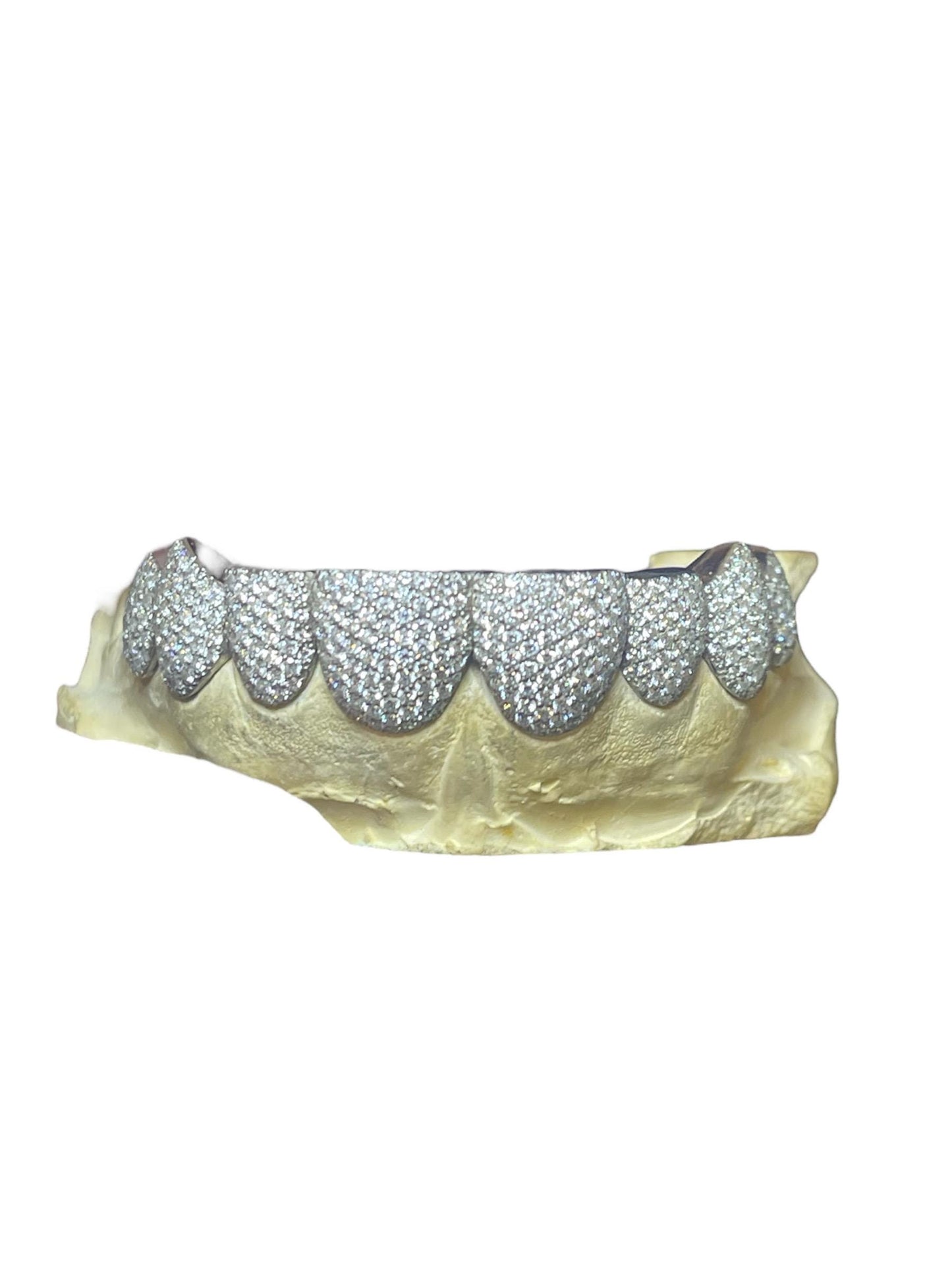 Custom Bustdown Grillz: Hand-Set Lab Diamonds, Silver or Gold