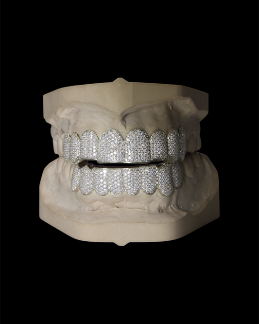 Custom Iced Lab Diamond Grillz: Sterling Silver, 10K/14K Gold
