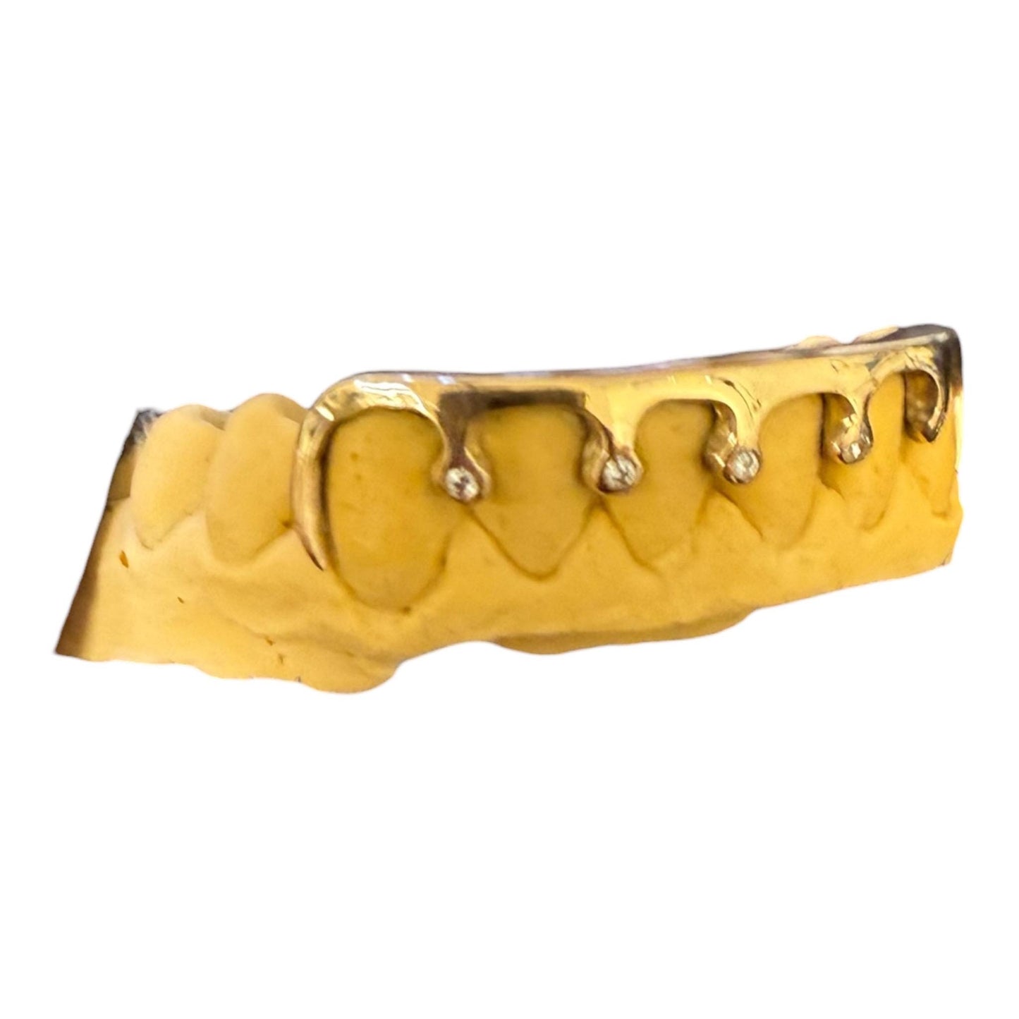 Drip Style Grillz – 6 Teeth Set | Lab VVS Diamonds | Silver or Gold | Custom Made