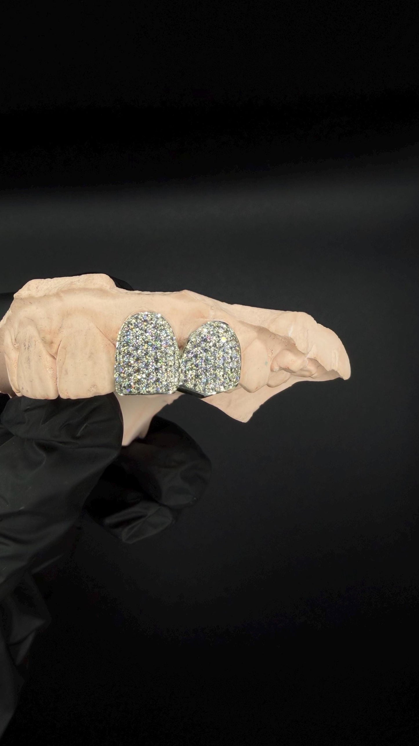 Custom two VVS Moissanite grillz, Sterling Silver or Gold