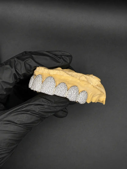 Side profile of luxury bustdown VVS-Moissanite grillz in silver and gold