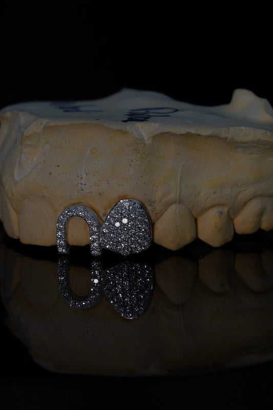Custom two-tooth VVS lab diamond grillz with a Bustdown Cap and Parallel Window Cap in solid precious metal.