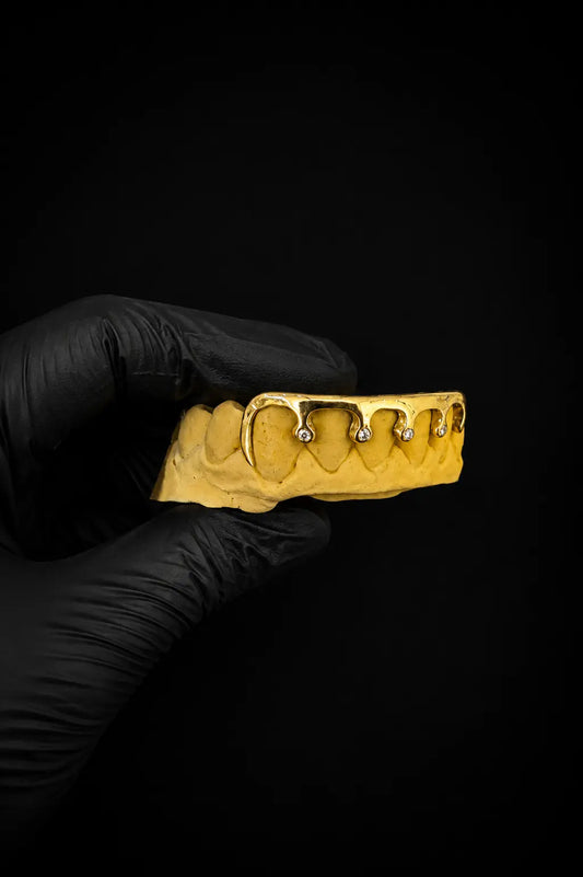 Side view of custom gold drip grillz with Lab VVS stones held with black glove
