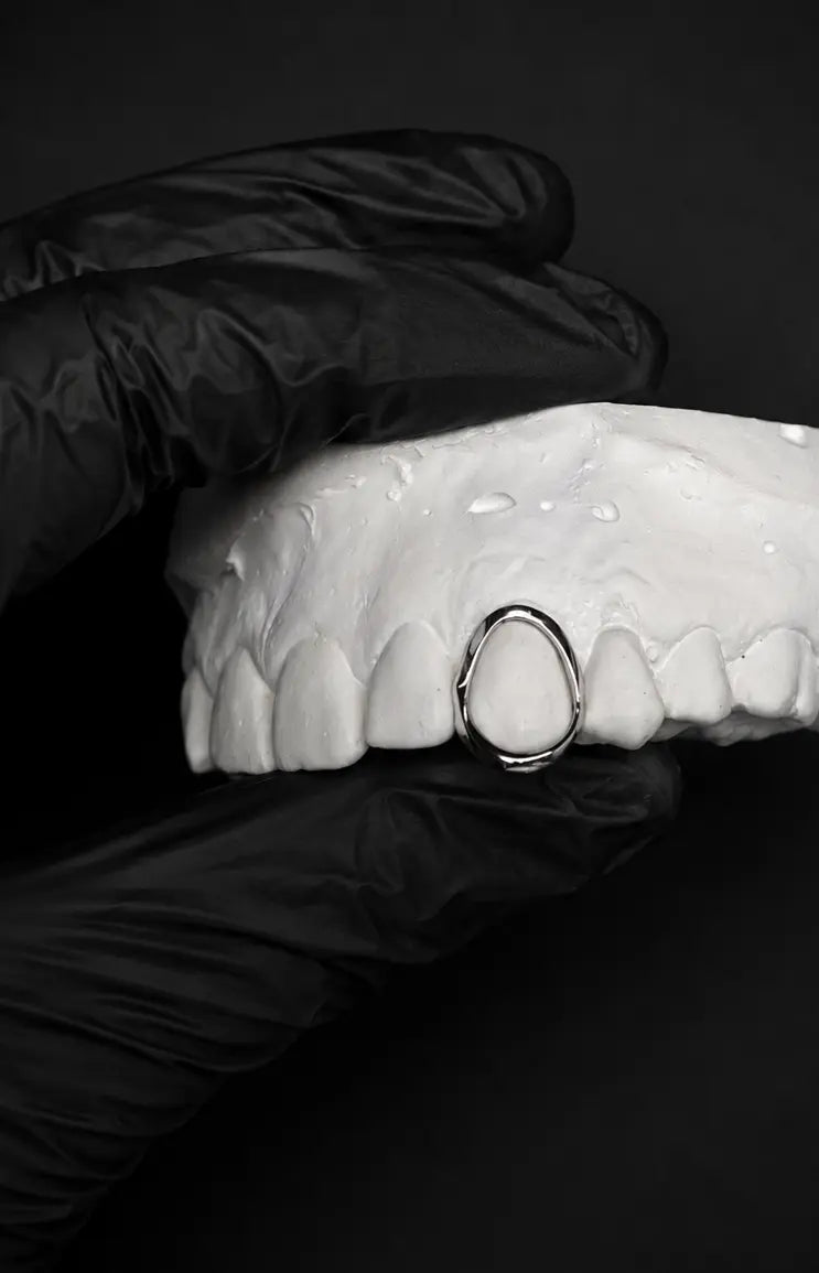 Custom open face grillz with gold upper teeth and silver lower teeth on a white dental model