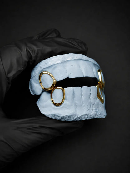 Custom gold open face grillz on a white dental model held with a black glove against a dark background