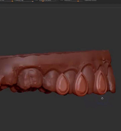 3D CAD model of luxury pear-cut VVS diamond grillz created for custom dental jewellery production