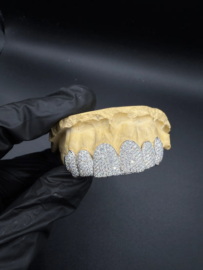 Close-up detail of VVS lab diamond grillz highlighting sparkle and craftsmanship