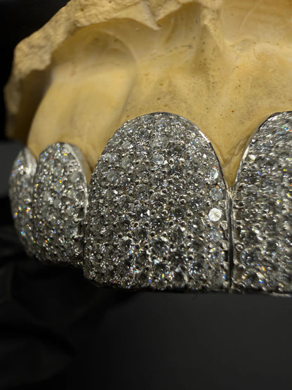 Close look of custom iced lab diamond grillz showing diamond setting and polish finish