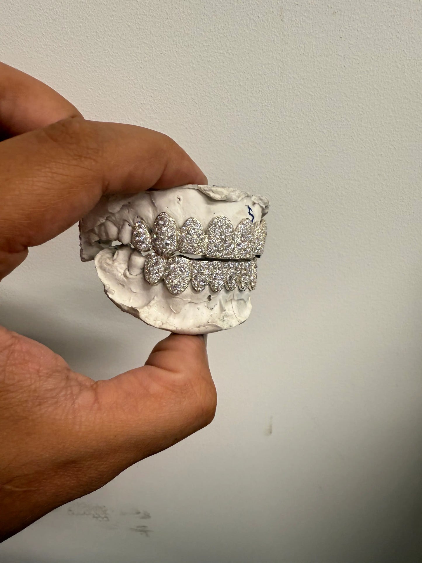 Side profile of custom moissanite snowset grillz in silver and gold