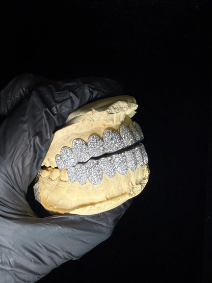 Close-up of mosaic snowset diamond arrangement on custom handcrafted grillz