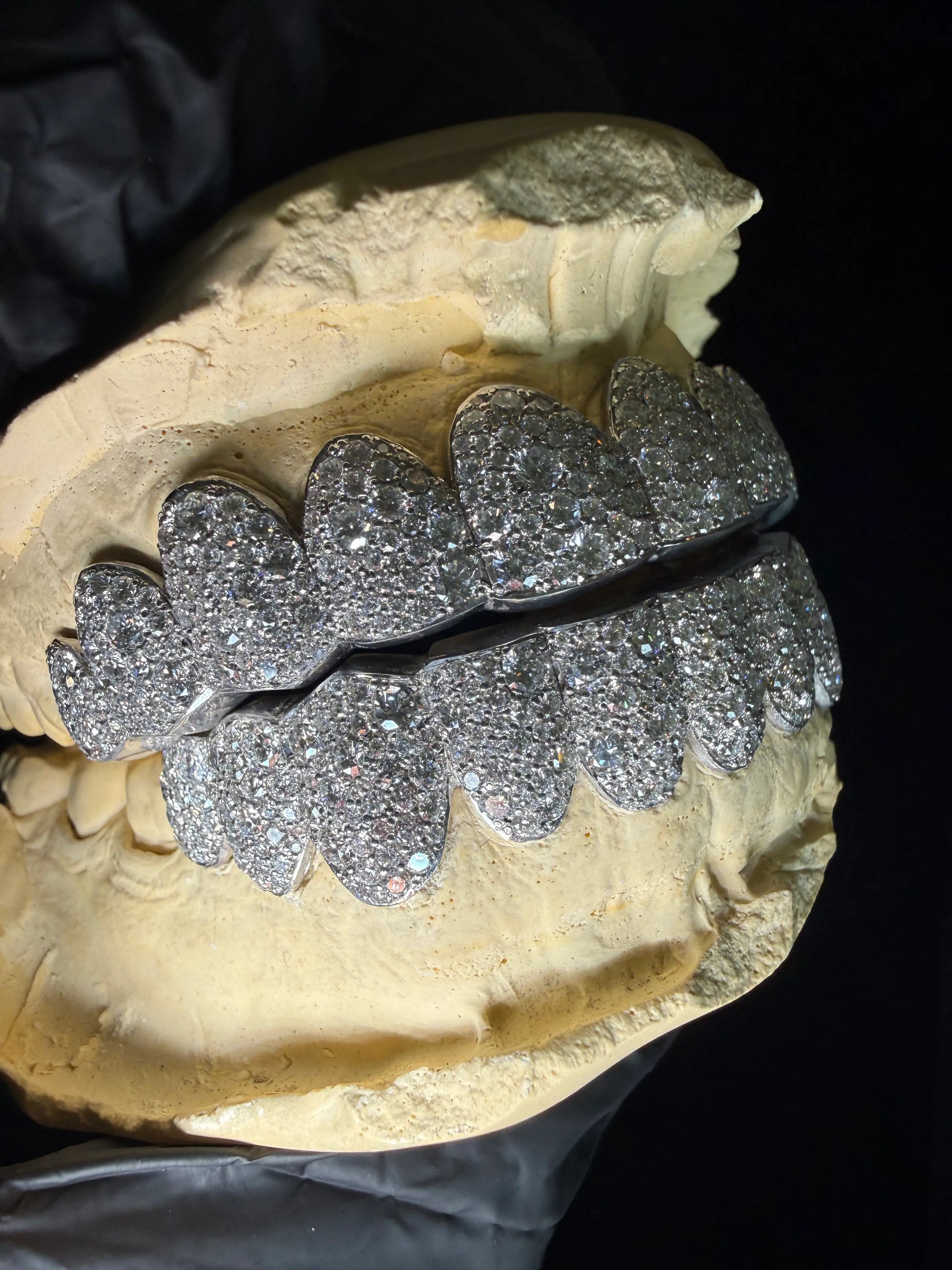 Detailed image of custom mosaic set lab diamond grillz with full iced-out smile