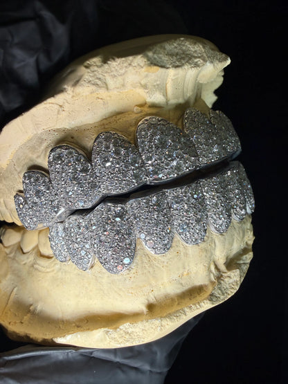 Detailed image of custom mosaic set lab diamond grillz with full iced-out smile