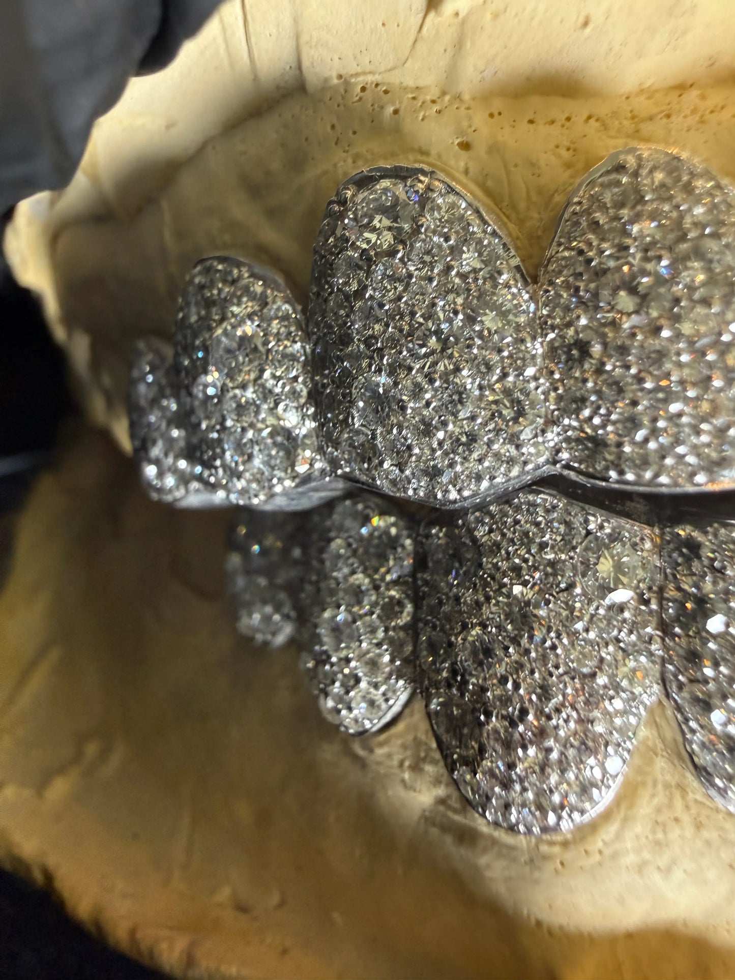 Side angle of fully iced-out Bustdown Snowset diamond grillz showing brilliant shine