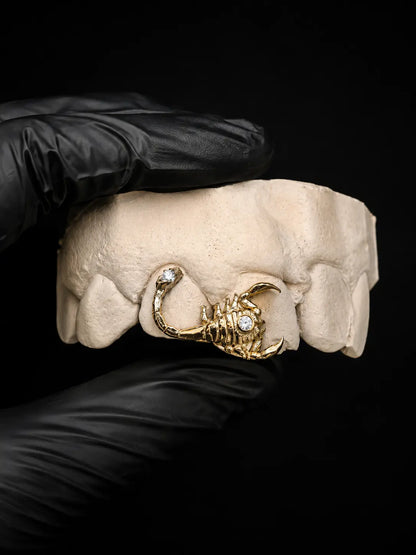 Close-up of custom scorpion grillz crafted with medical-grade precision and gemstone details