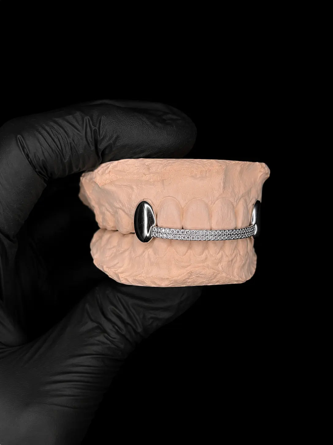 Side profile of handcrafted VVS lab diamond grillz on dental cast