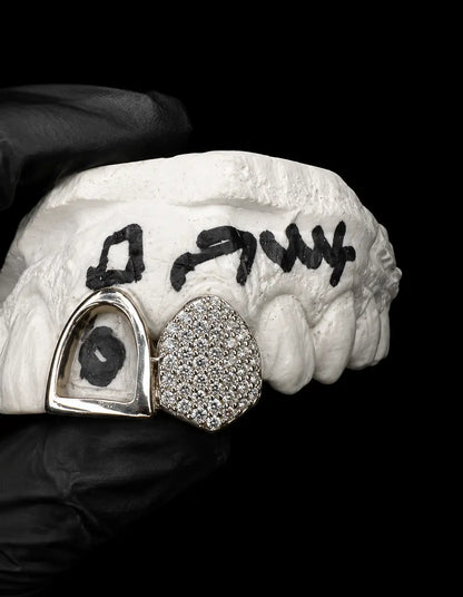 Custom double grillz set with VVS lab diamonds displayed on black background with luxury studio lighting