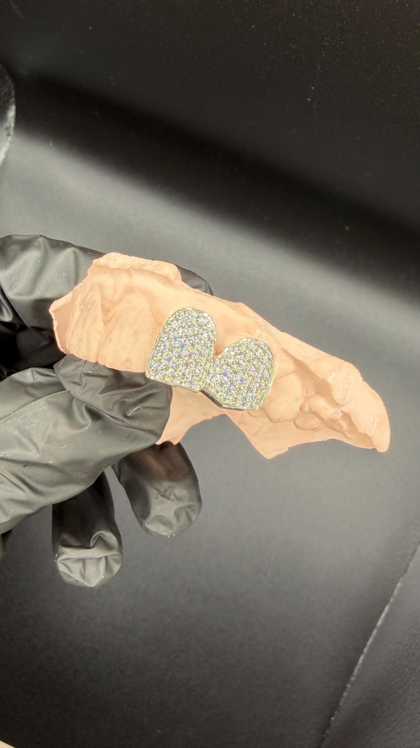 Custom two VVS Moissanite grillz, Sterling Silver or Gold