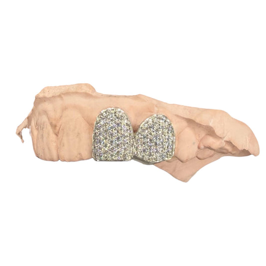 Custom two VVS Moissanite grillz, Sterling Silver or Gold