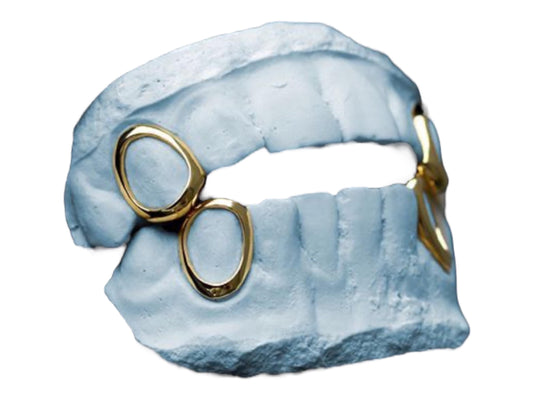 Custom Gold Grillz: Open Face Design, High-Gloss Polish