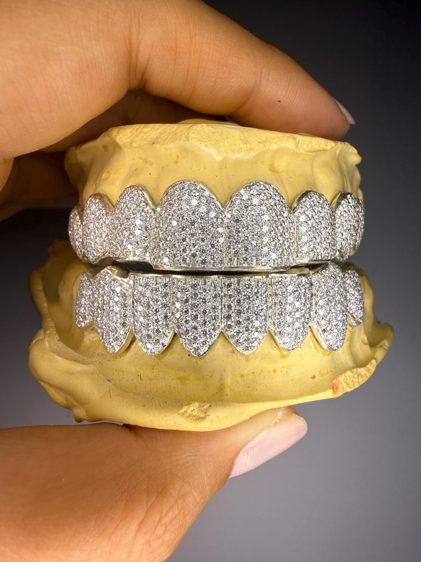 Custom Bustdown Grillz: Hand-Set Lab Diamonds, Silver or Gold