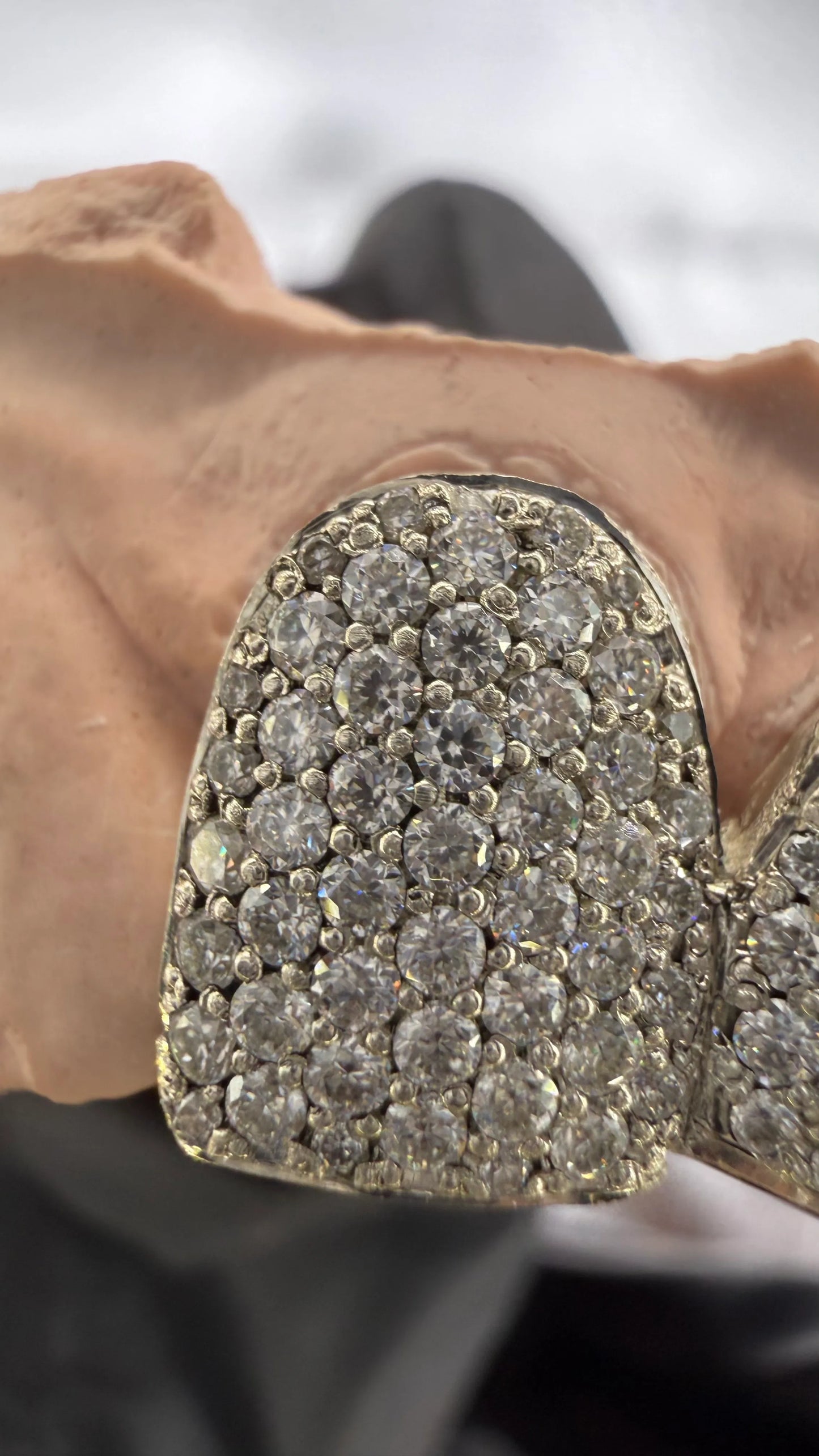 Extreme close-up of moissanite stones on luxury custom grillz