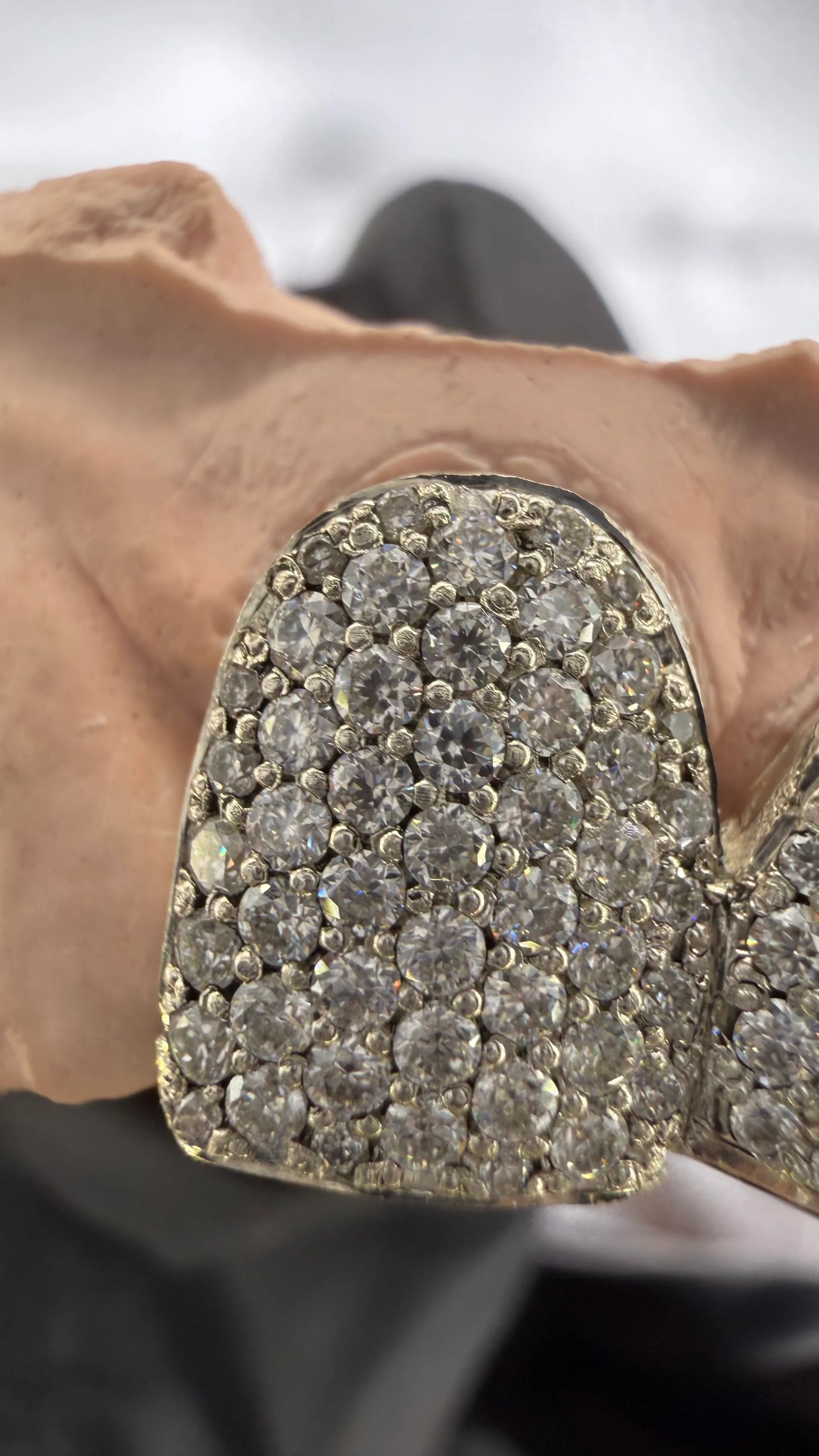 Extreme close-up of moissanite stones on luxury custom grillz
