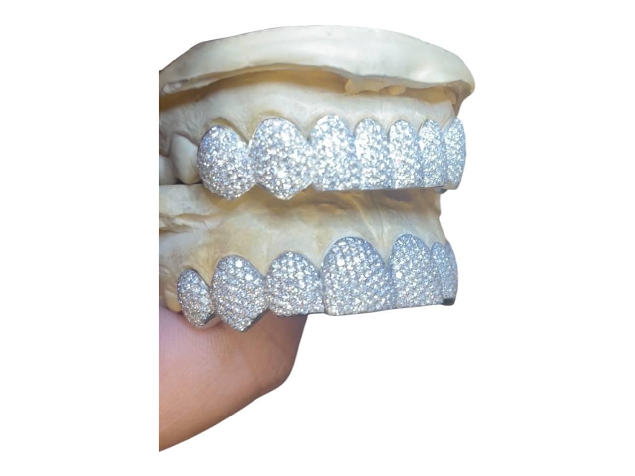 Custom Iced Grillz: VVS Moissanite, Sterling Silver or Gold