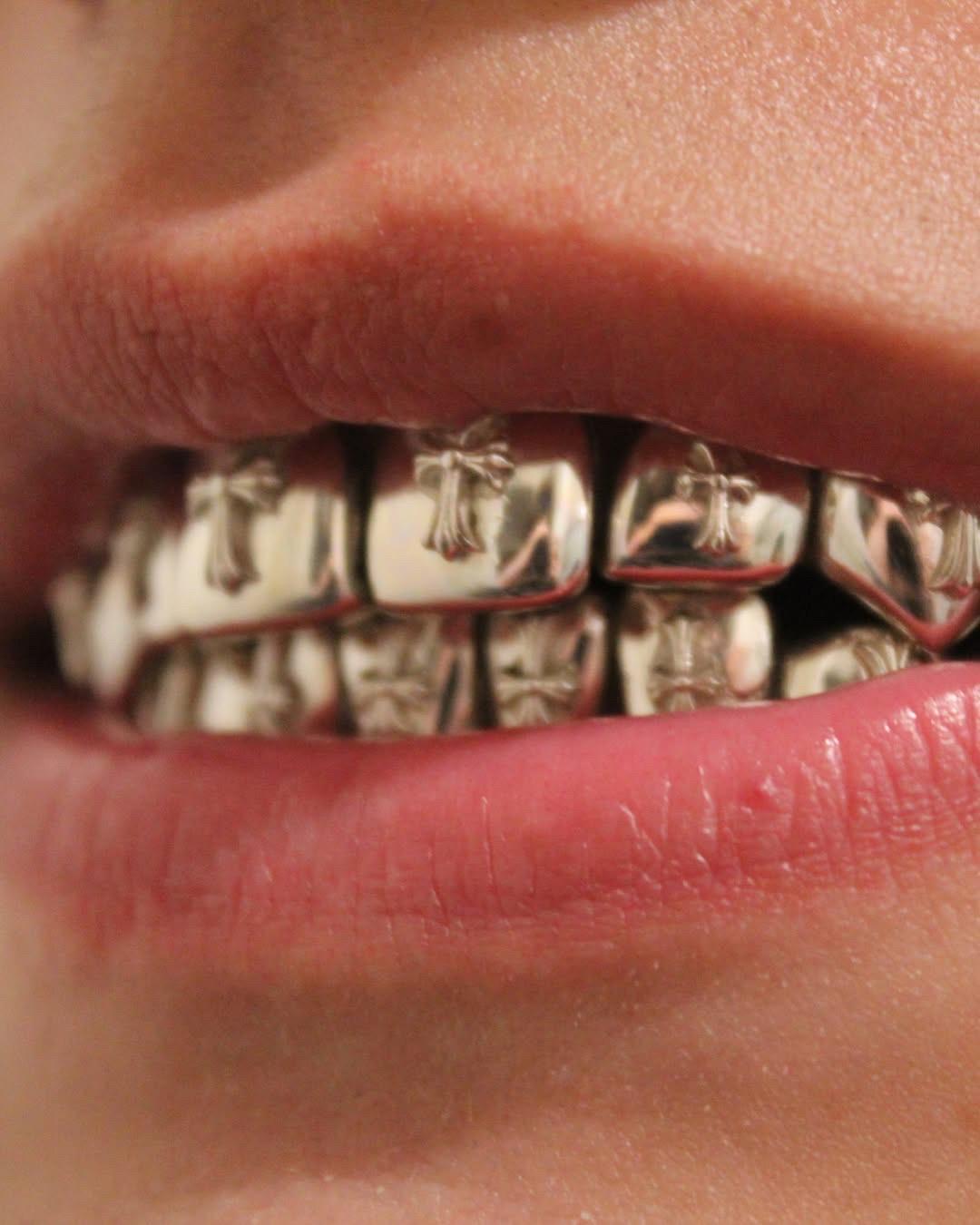 CAD-designed Cross Grillz  – 925 Silver or 9K/14K Gold – Dental-Grade Fit