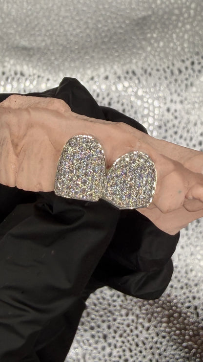 Close-up of gold and silver custom grillz material with moissanite stones