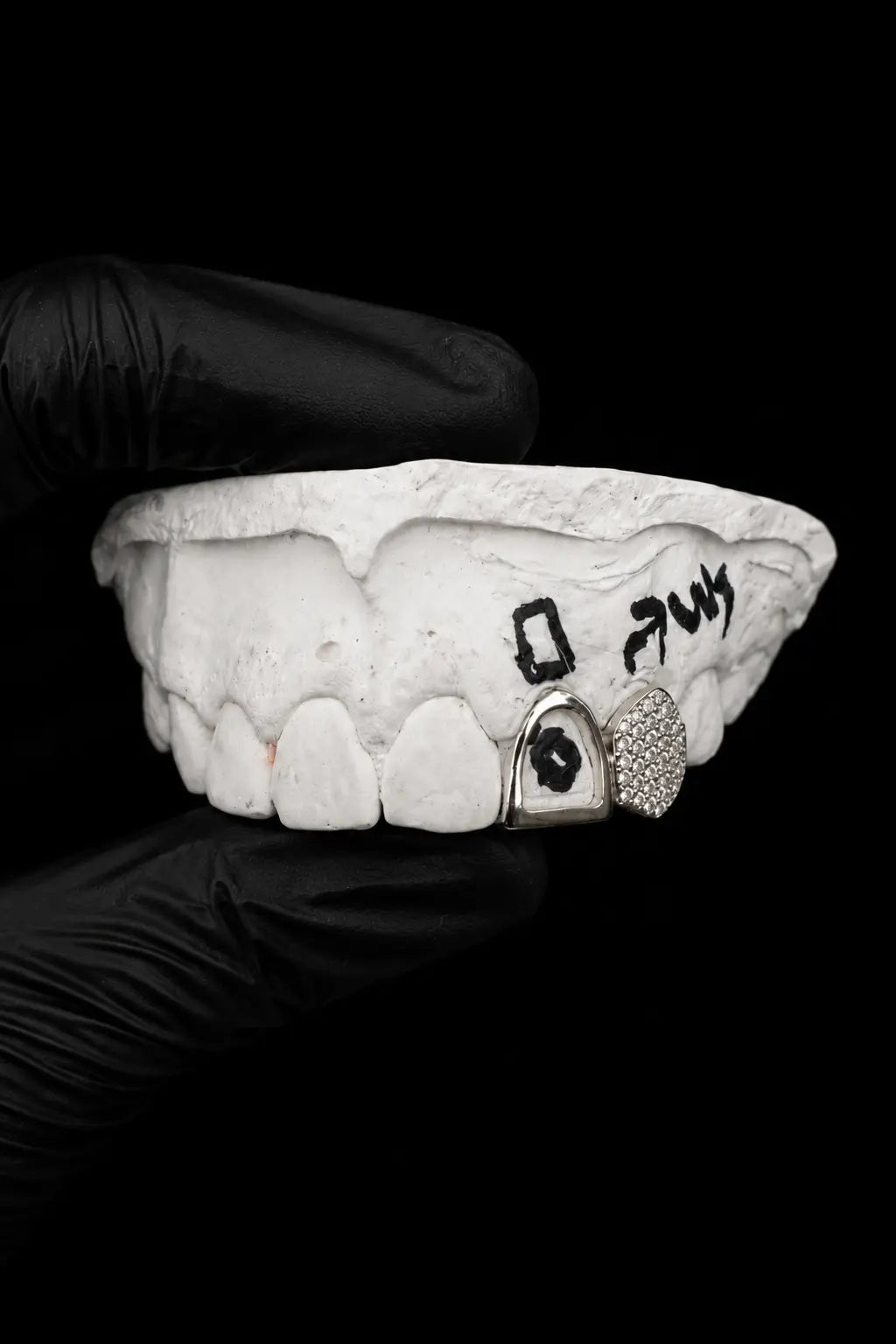 Custom gold and silver lab diamond grillz displayed on dental mold with black glove background