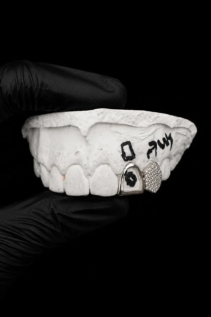 Custom gold and silver lab diamond grillz displayed on dental mold with black glove background
