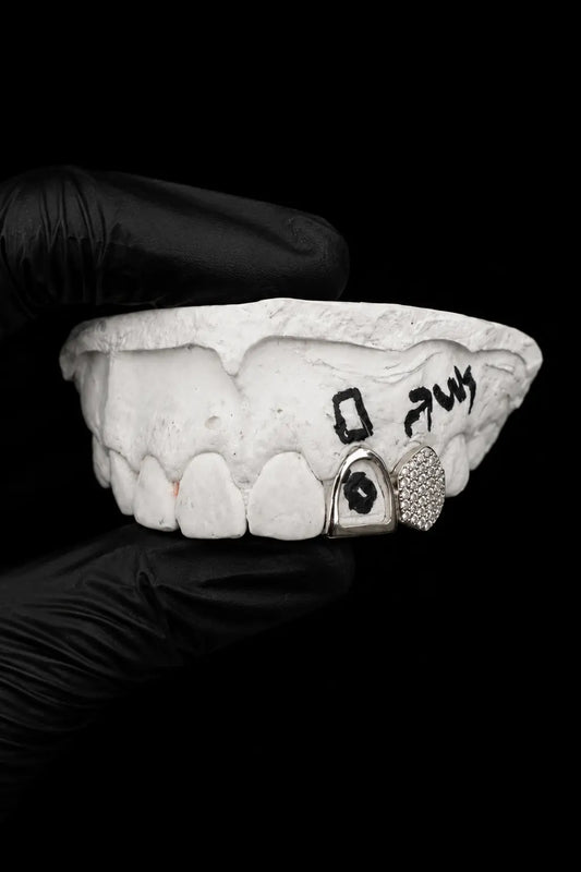 Custom gold and silver lab diamond grillz displayed on dental mold with black glove background